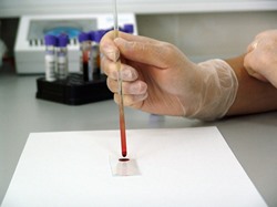 Pacifica CA phlebotomist testing blood sample